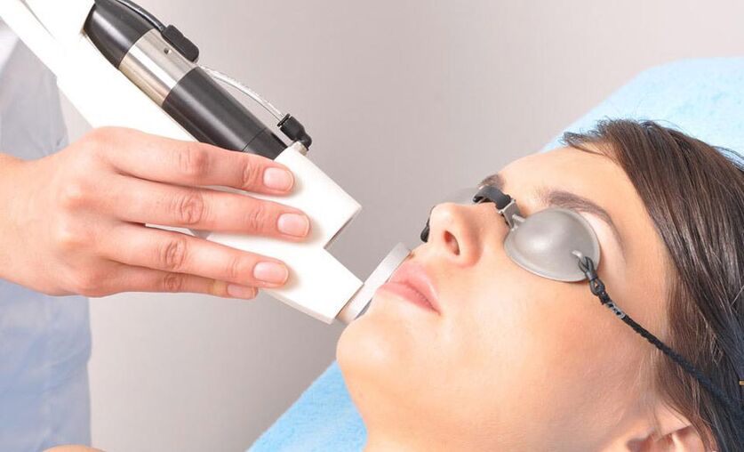 Laser apparatus skin rejuvenation