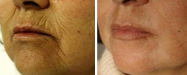 Rejuvenate 4D